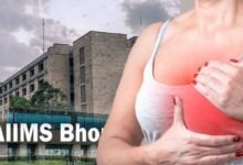 चौथे स्टेज के स्तन कैंसर में भी इलाज की उम्मीद, बीमारी की पहचान के आधार पर तय होगा उपचार