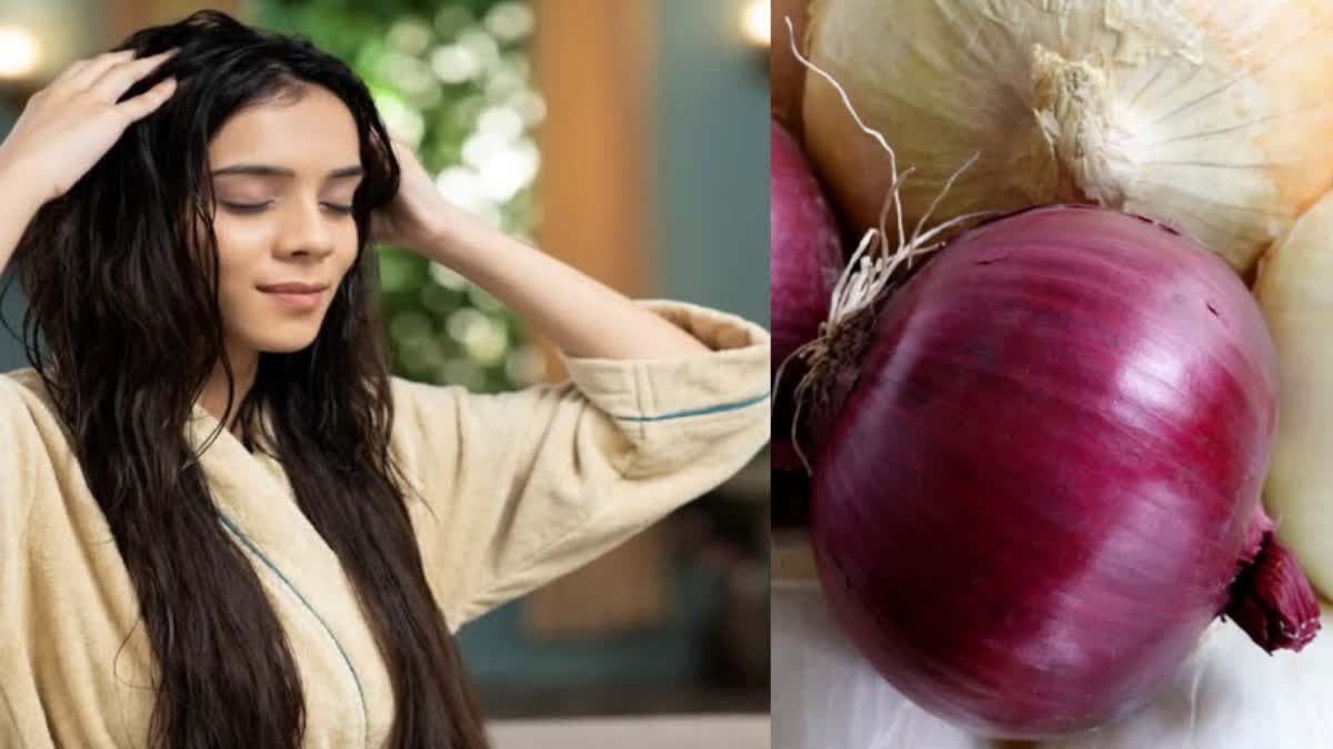 बारिश में तेजी से झड़ रहे बाल? प्याज के रस की ये ट्रिक करें, जड़ों से मजबूत होंगे बाल बारिश में तेजी से झड़ रहे बाल? प्याज के रस की ये ट्रिक करें, जड़ों से मजबूत होंगे बाल