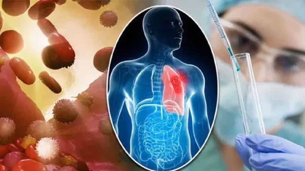 कैंसर मरीजों के लिए राहत की खबर, अब ट्यूमर पर रियल टाइम नजर रखकर दिया जा सकेगा सटीक रेडिएशन