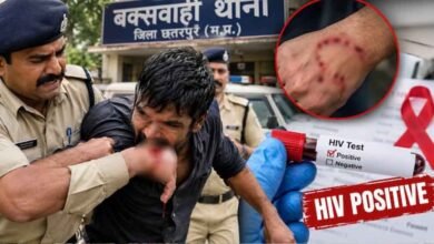 छतरपुर में रेप के आरोपी ने कांस्टेबल को काटा, मेडिकल जांच में HIV पॉजिटिव छतरपुर में रेप के आरोपी ने कांस्टेबल को काटा, मेडिकल जांच में HIV पॉजिटिव